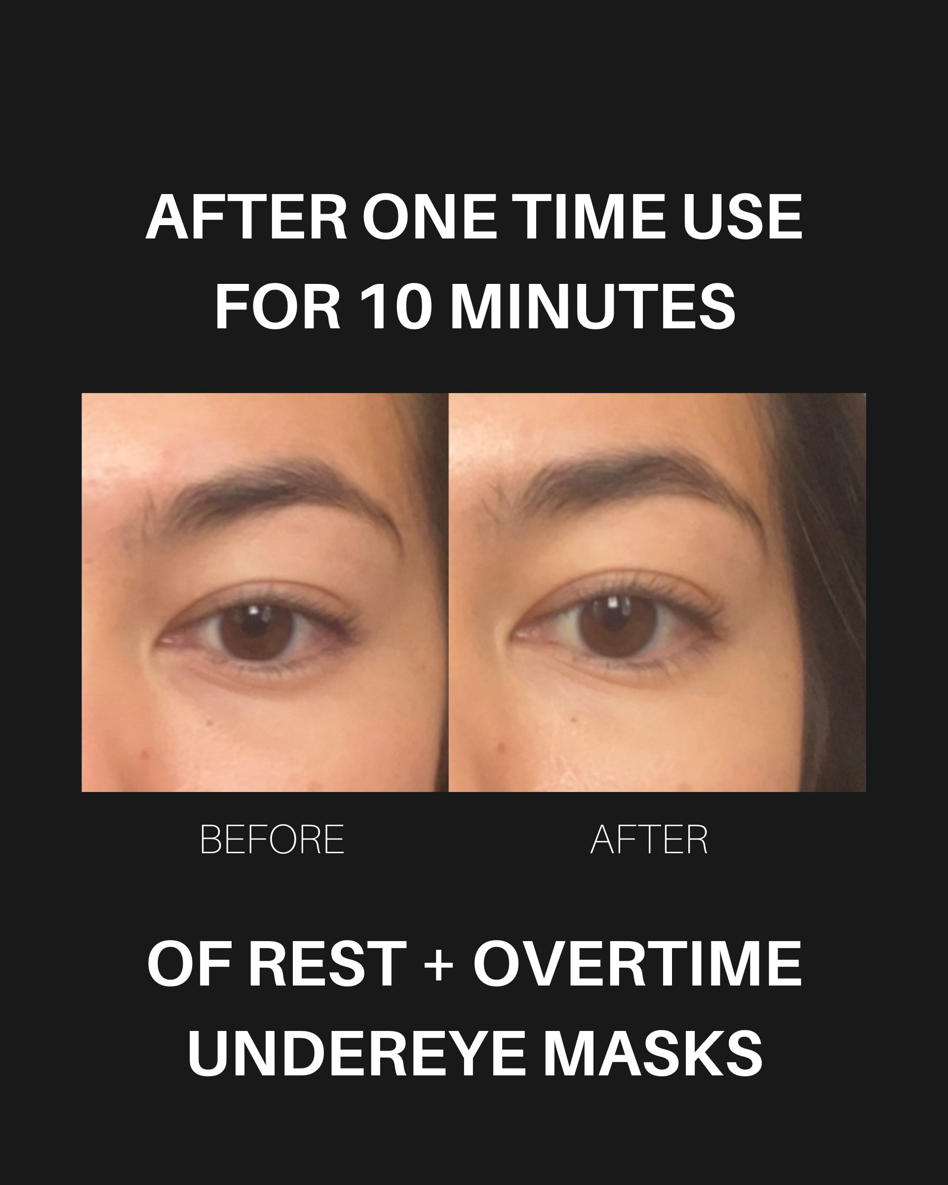 Overtime Undereye Masks